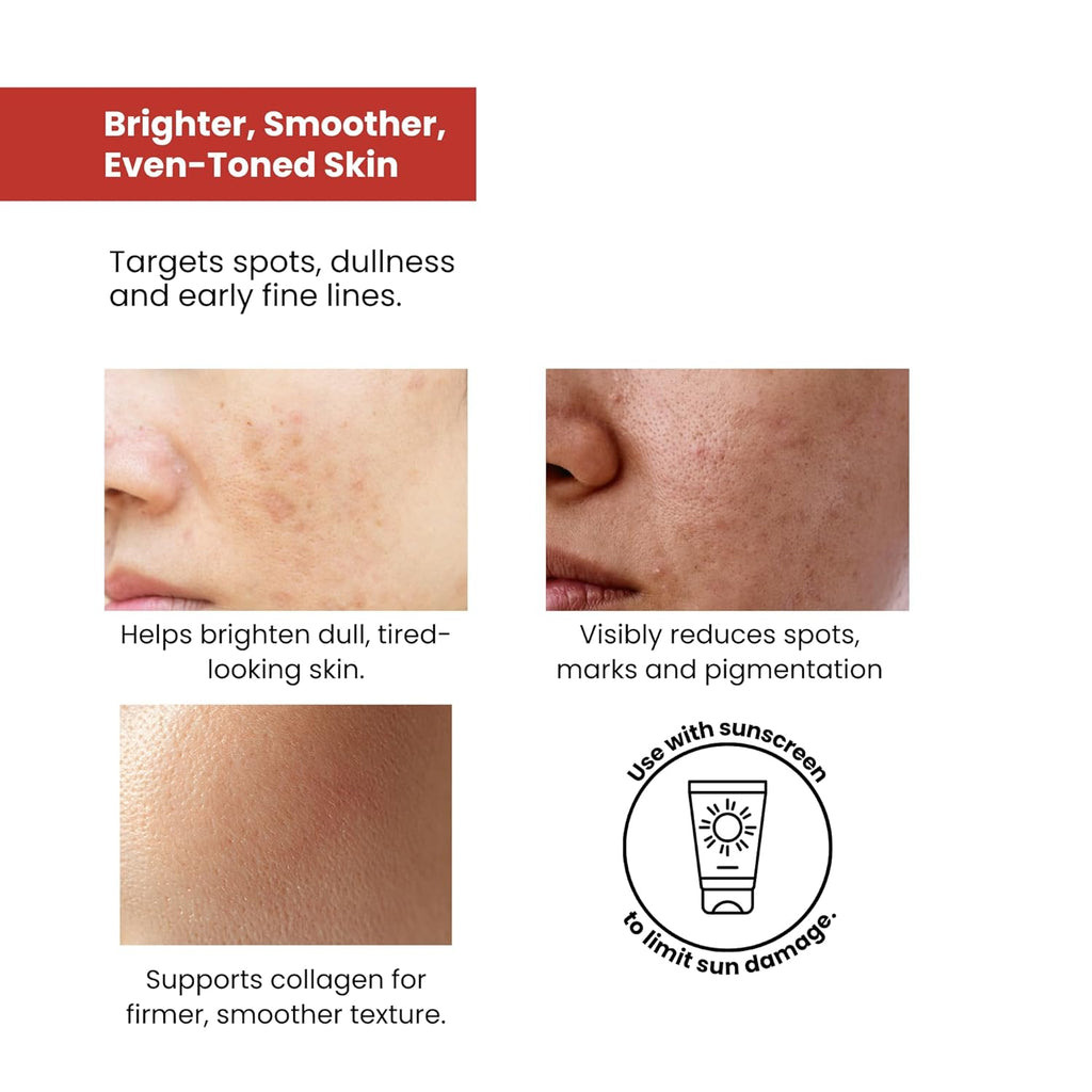 The True Therapy Vitamin C Serum for Glowing Skin, Skin Brightening Serum for Face with 10% L-Ascorbic Acid Face Serum, Fragrance Free â€“ 30 ml