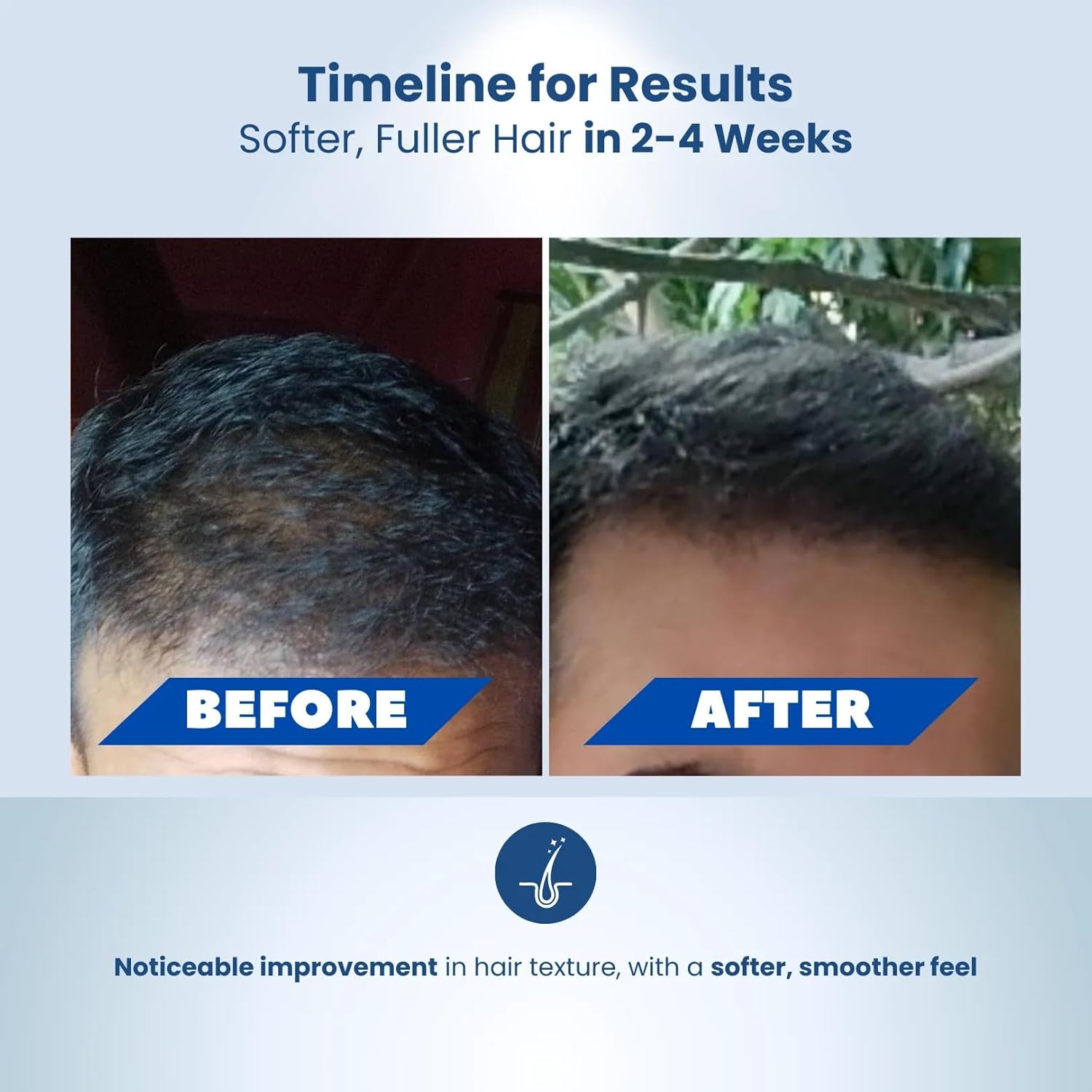 Adon (Waidon) Herbal Shampoo For Hair Fall Control &And  ReGrowth - 200 ml