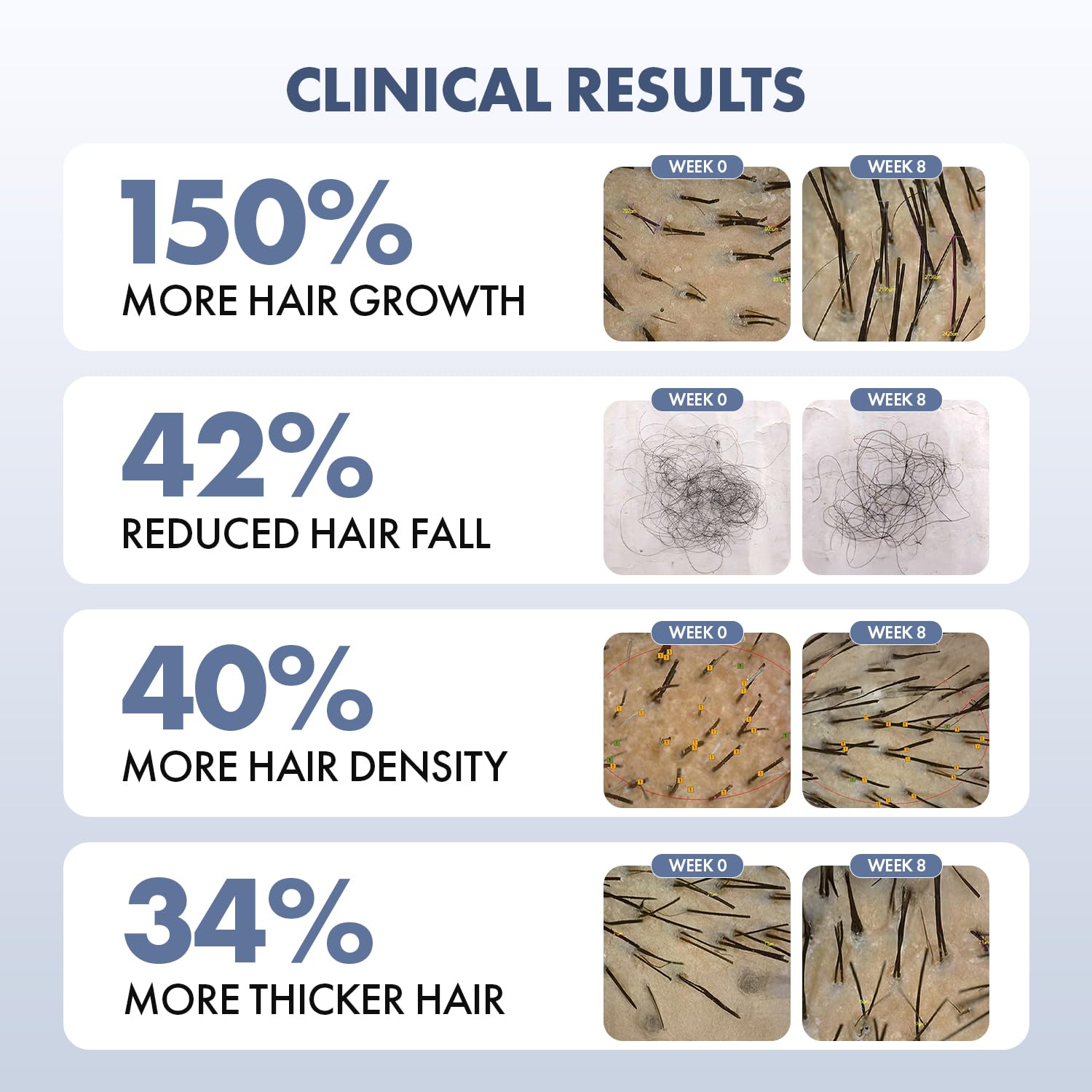 ThriveCo Hair Growth Serum 2.0, Advanced Patent Filed Clinically Proven Scalp Treatment for Hair Fall Control & Regrowth, British Medical Publication, Lightweight, Non-Sticky Solution, Unisex, 50ml