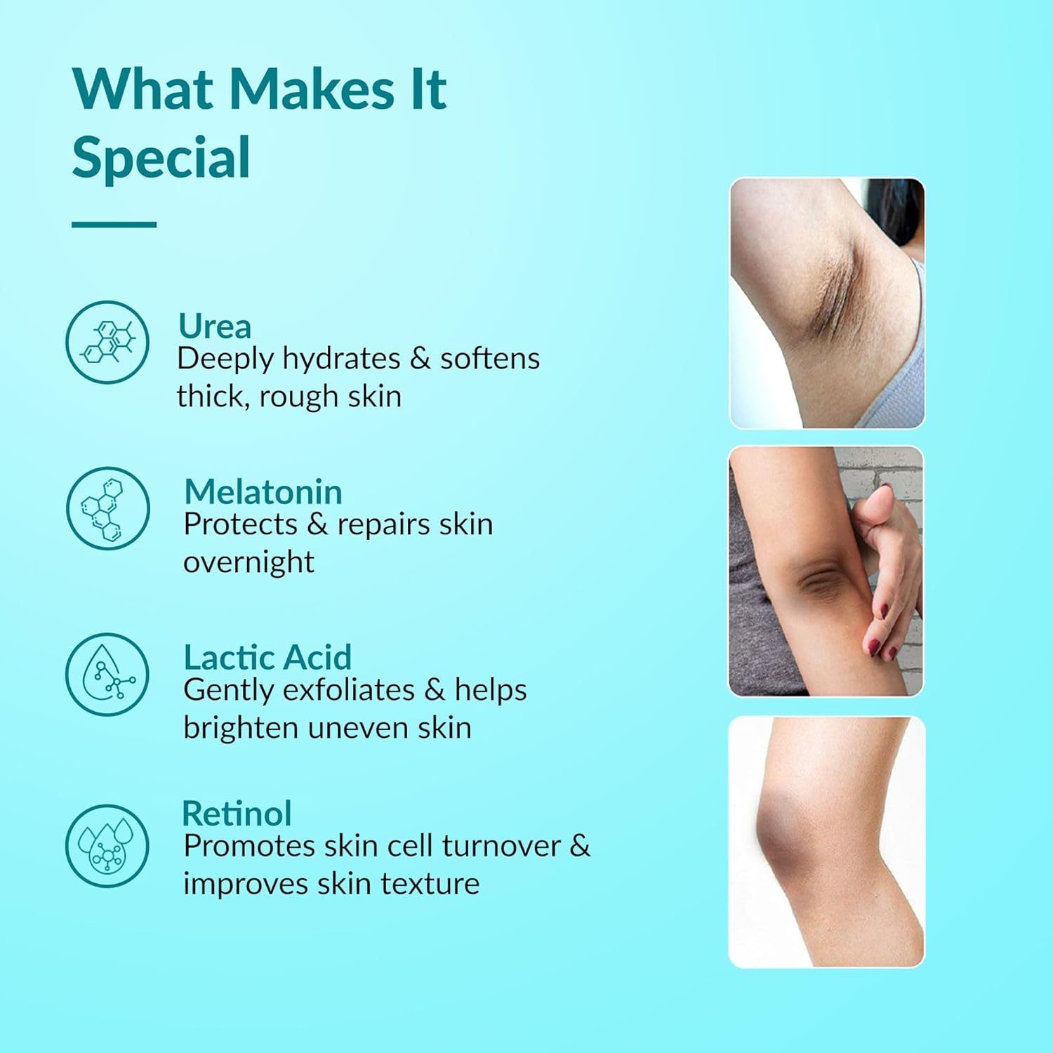 Fixderma Nigrifix Advance Cream for Acanthosis Nigricans with Melatonin, Retinol & Lactic Acid | For Dark Body Parts like Neck, Ankles, Knuckles, Armpits, Thighs & Elbows | Dermatologist Tested - 50g