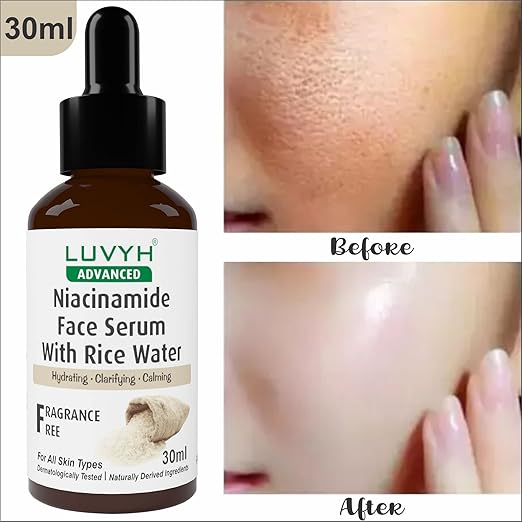 Luvyh Niacinamide Face Serum with Rice Water - 30 ml