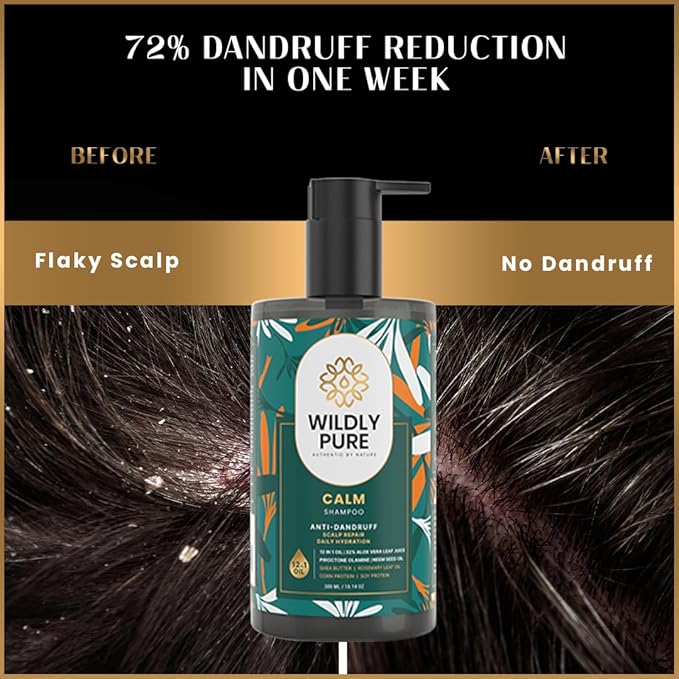 Wildly Pure Natural Anti Dandruff Shampoo  -300 ml