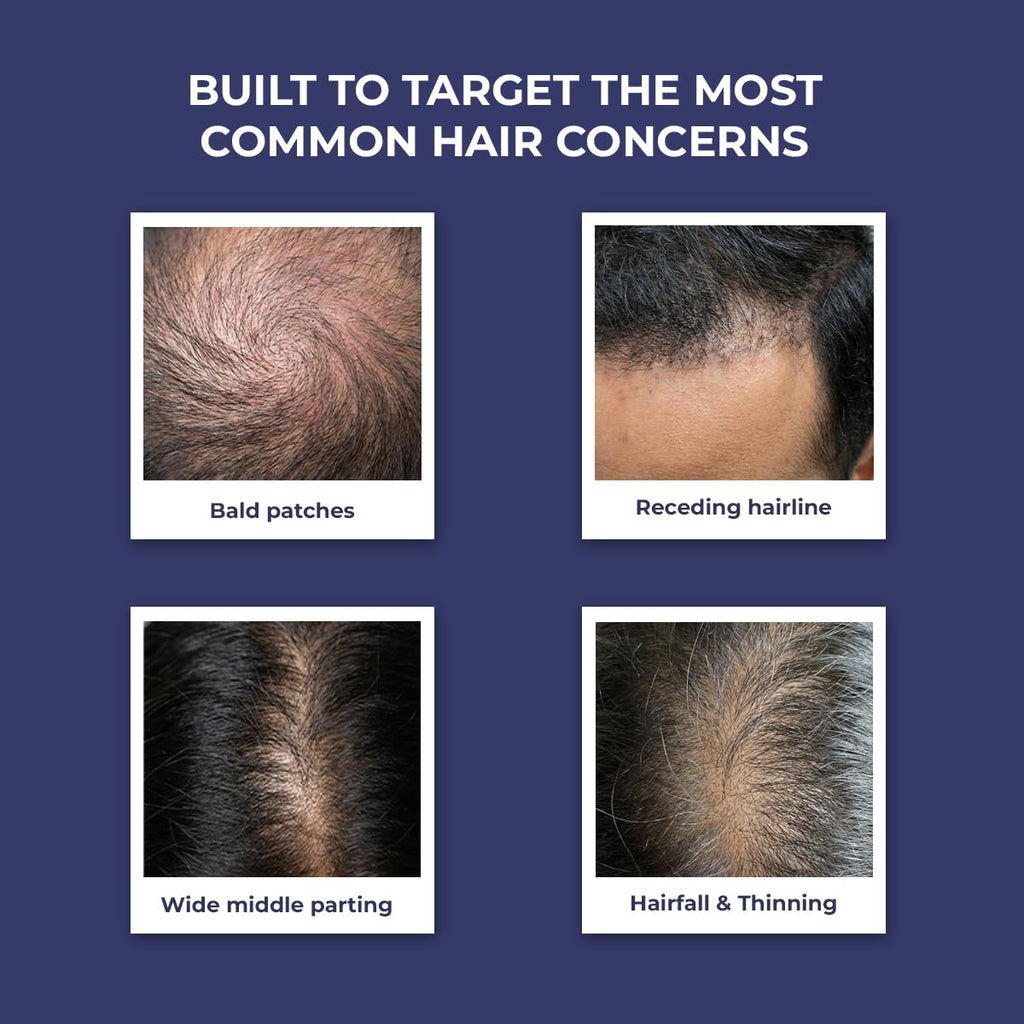 Conscious ChemistÂ® Rosemary Water Spray for Hair Growth | Anti Hair Fall Scalp Spray with Tripeptide-1 & Redensyl | Boosts New Growth & Strengthens Roots | Lightweight Non-Greasy Hair Mist | For All Hair Types | Women & Men | 200ml