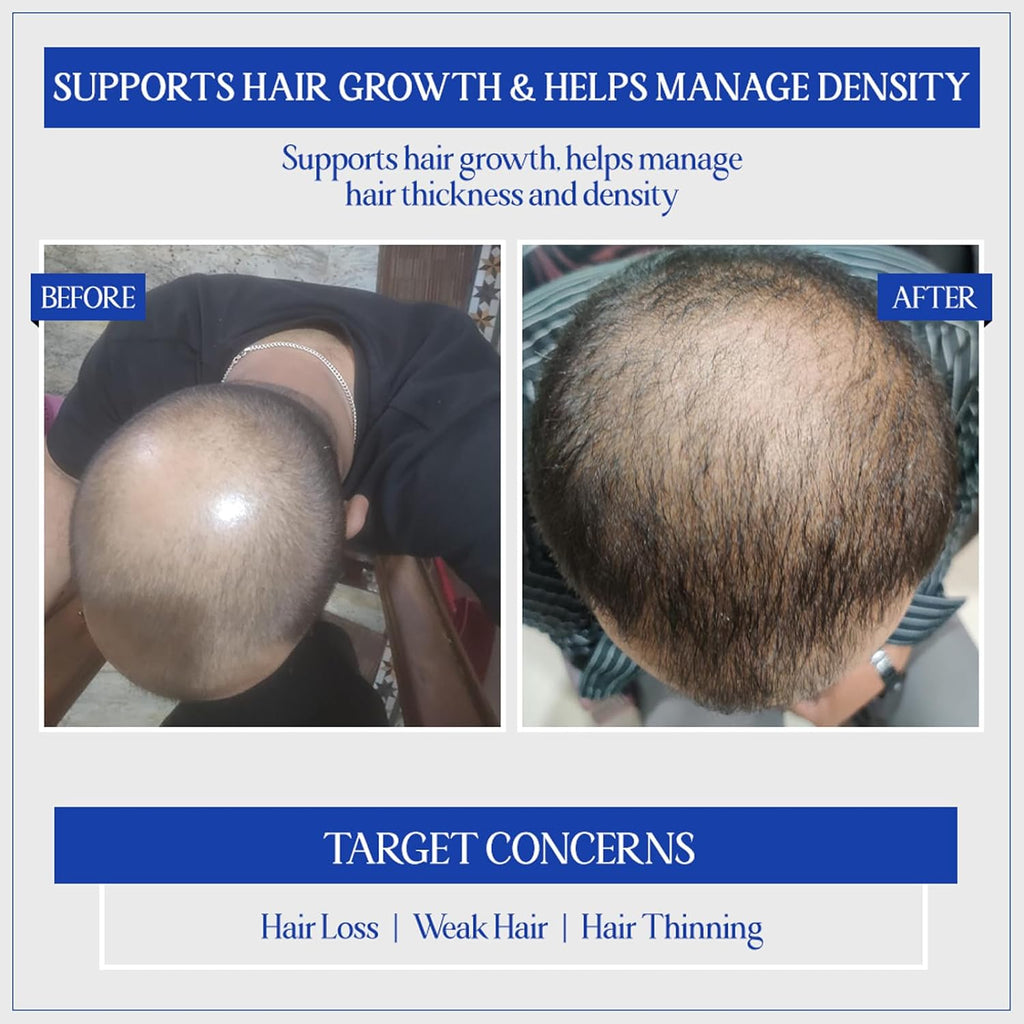 Trust Your Choice Herbal Hair Growth Serum - 50 ml