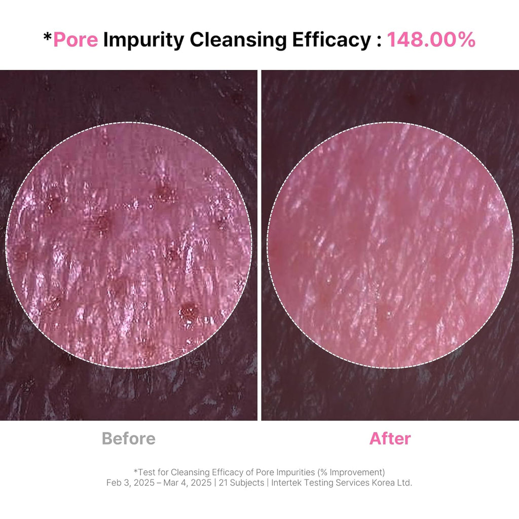 4-in-1 Konjac Jelly Face Cleanser â€“ Gentle Daily Exfoliating, Deep Cleansing, Pore Care & Makeup Removal | Berry Smoothie Texture with Raspberry & Vitamin B+C+E Complex | Dermatologist-Tested - 130 ML