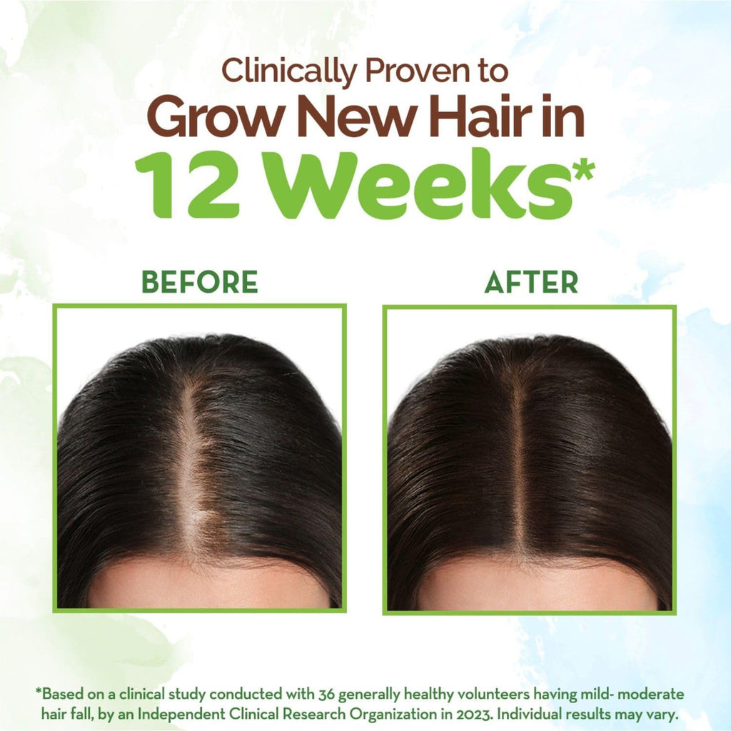 Mamaearth Rosemary & Methi Dana Hair Oil - Promotes Growth, Controls Fall, Strengthens & Stimulates New Growth | 200 ml