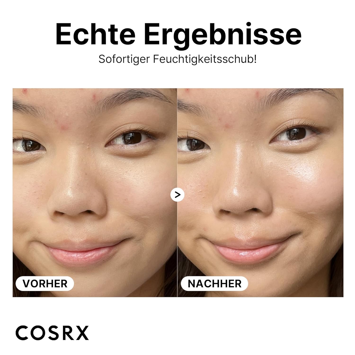 COSRX Pure Sodium Hyaluronic Acid 3% Serum - 20 ml