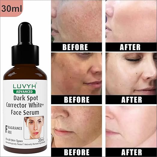 Luvyh Dark Spot Corrector White+ Face Serum - 30 ml