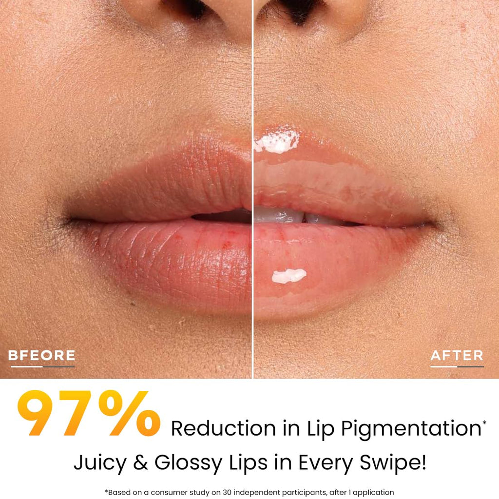 Hyphen Mango Lip Balm SPF 50 PA++++ | 2% Kojic Acid Brightening LipBalm for Dark & Pigmented Lips | 1% Vitamin E & Vitamin C | Moisturizing SPF LipBalm for Dry Lips - 10 g