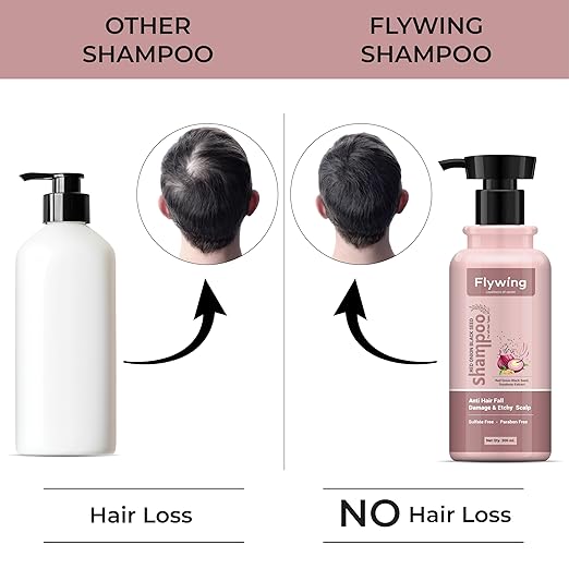 Flywing Red Onion Shampoo - 300 ml