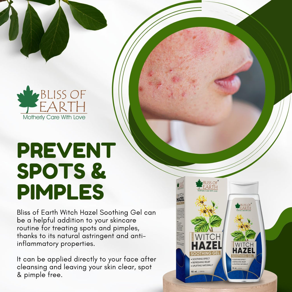 Bliss of Earth Witch Hazel Gel for Hemorrhoids, Diaper Rashes, Postpartum Soothing Relief from Swelling and Discomfort, 110ml