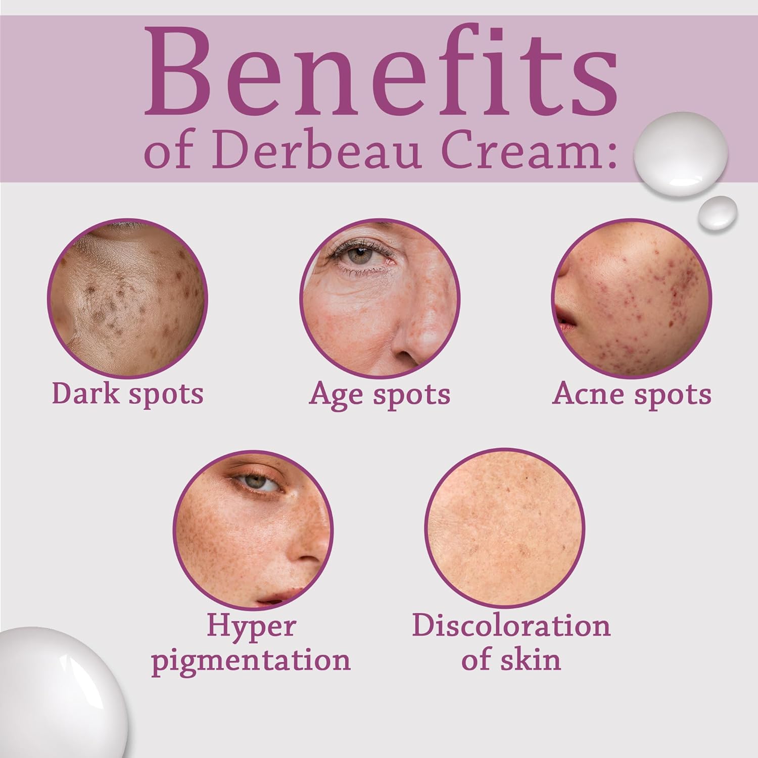 Healing Pharma - DerbeauÂ® Glycolic Acid Cream 12% W/W, 30g