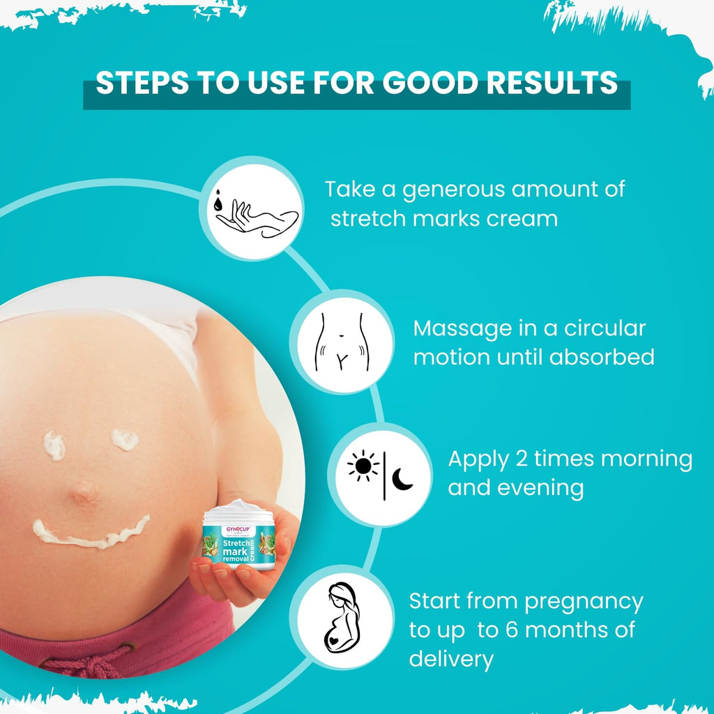 MildCares Stretch Marks Removal Cream (50gm) | For Prevents Stretch Marks, Nourish & Hydrating Skin | With Shea Butter, Saffron, Kokum Butters | All Skin Types | Stretch Marks Cream For Women