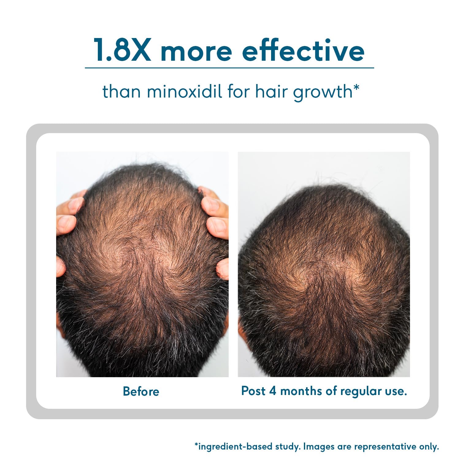 HK Vitals by HealthKart Headful Growth+ Serum with 3% Redensylâ„¢, 3% Procapilâ„¢, & 5% Capixylâ„¢ (30ml) | For Hair Growth & Hair Fall Control | Dermatologically Tested