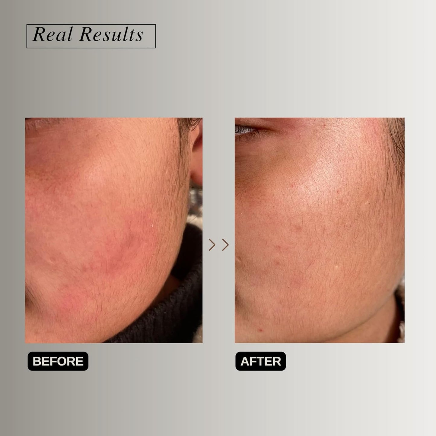 The Formularx Peptide Ceramide Moisturizer  -50 gms