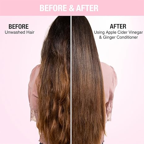 Nykaa Naturals Apple Cider Vinegar & Ginger Anti-Dandruff Conditioner - 180 ml