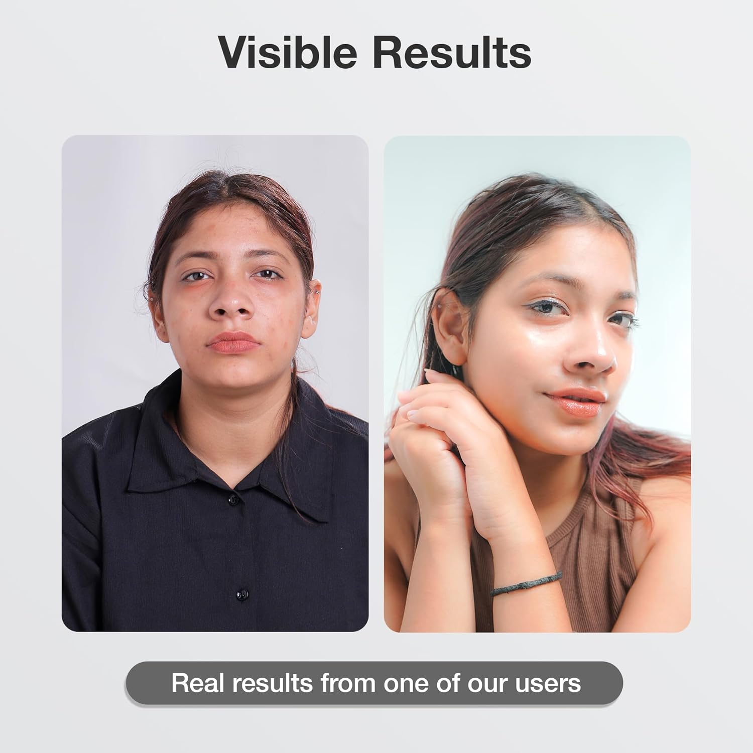 Cos-IQ Vitamin B3-5% Niacinamide Face Wash for Smooth and Even Skin, Tan Removal & Glowing Skin, pH Balanced & Paraben Free (30 Days Pack, 100ml)