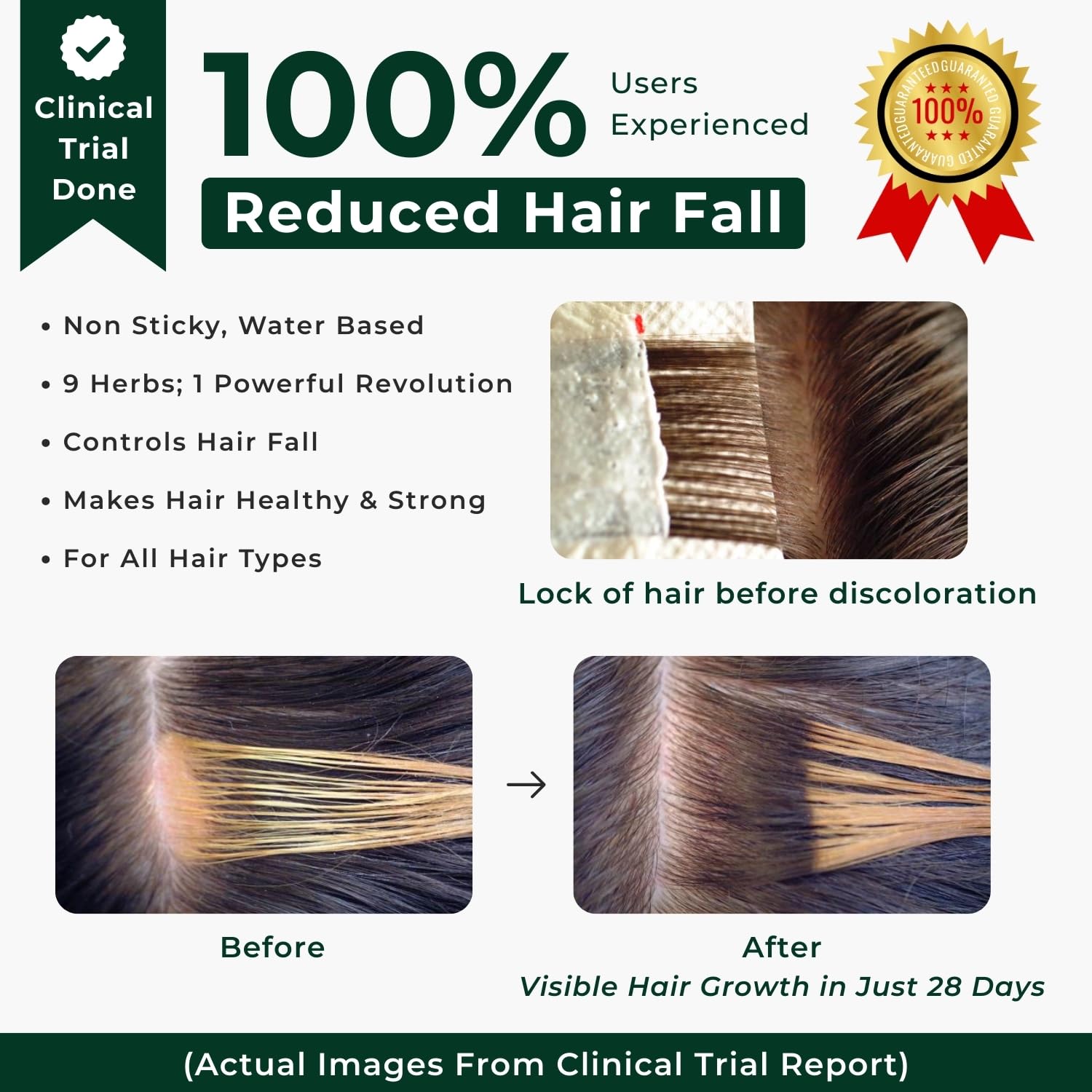 Aroma Treasures Hair Growth Serum For Scalp (Spray), Hibiscus & Bhringraj Scalp Rasa, Controls HairFall & Boosts New Hair Growth, In-Vivo Tested, For Men & Women, Non-Sticky, Water-Based Formula (60ml)