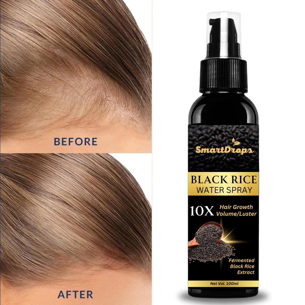 Smartdrops Rice Water Spray for Women & Men, for Hair Growth Thinning Hair and Hair Loss Control Spray 100 ml (Pack Of 1)