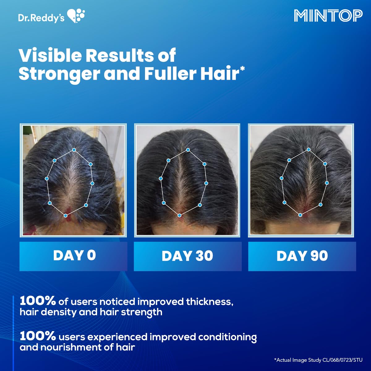 Dr. Reddy's Mintop Hair Regrowth Serum - 50 ml