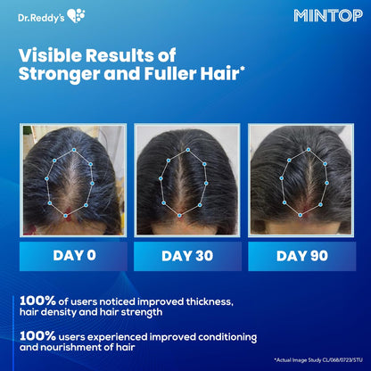 Dr. Reddy's Mintop Hair Regrowth Serum - 50 ml