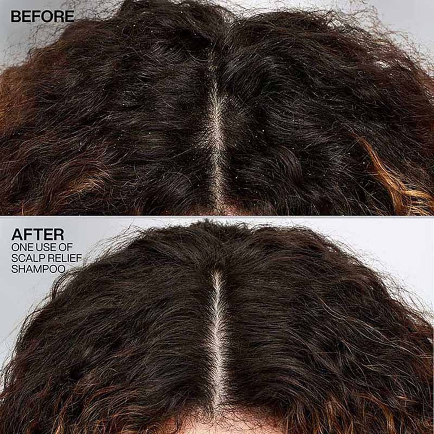 Redken Scalp Relief Anti Dandruff Shampoo For Men & Women