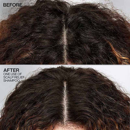 Redken Scalp Relief Anti Dandruff Shampoo For Men & Women