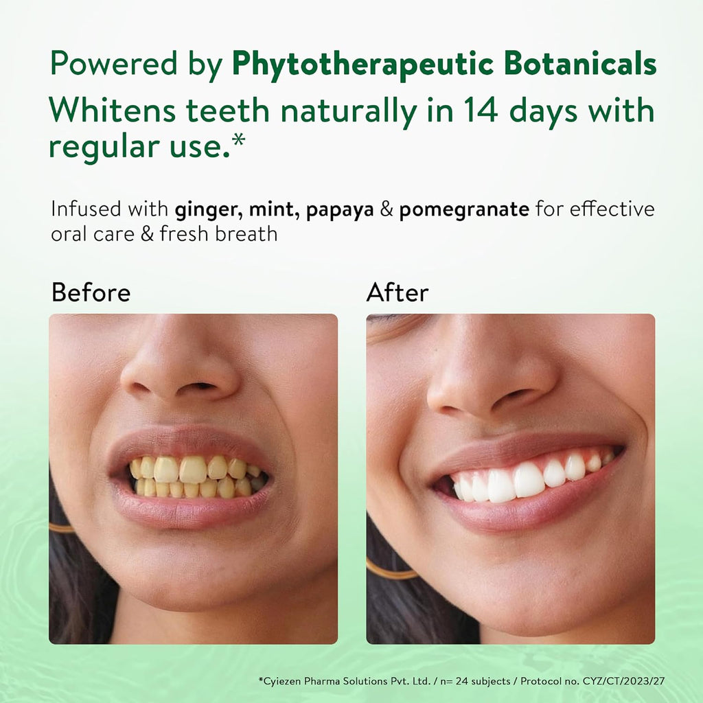 Ayouthveda Ayurvedic Natural Whitening Toothpaste | Plant-Based Formula with Ginger, Mint, Papaya & Pomegranate | Plaque & Tartar Control | Gum Comfort, Enamel Care & Fresh Breath | 100g (Pack of 1)