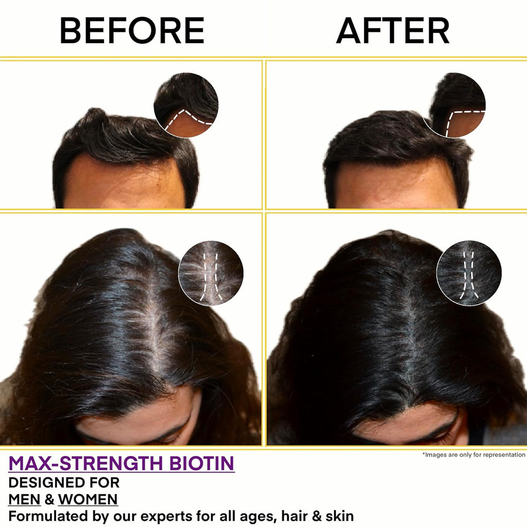 BioClinical Biotin Tablets for Hair Growth - Biotin 10000mcg for Hair,Skin & Nails - Supplement for Men & Women Hair Growth - Vegan Vitamin B 7 -PureVe Forte Medicine -120 Veg Tablets