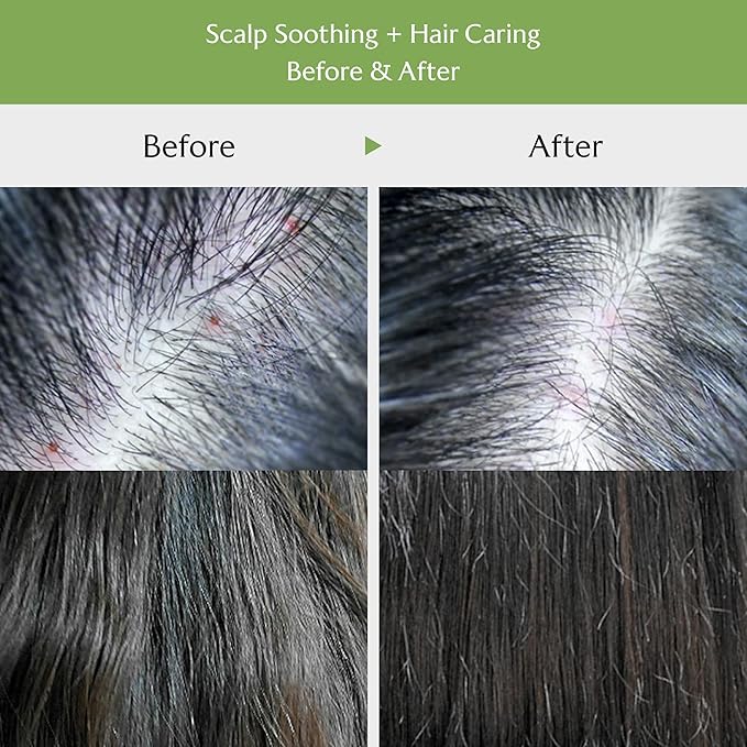 La'dor Tea Tree Scalp Clinic Hair Pack - 200 Ml