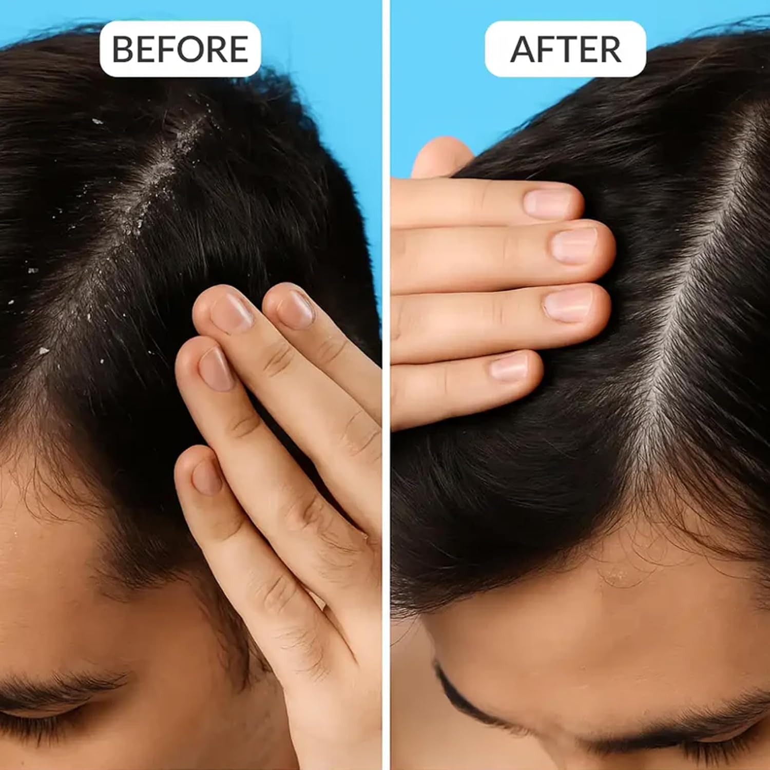 Beauty Garage ScalpSense Hydra Soothe for Dry Scalp Vaccine 150ml