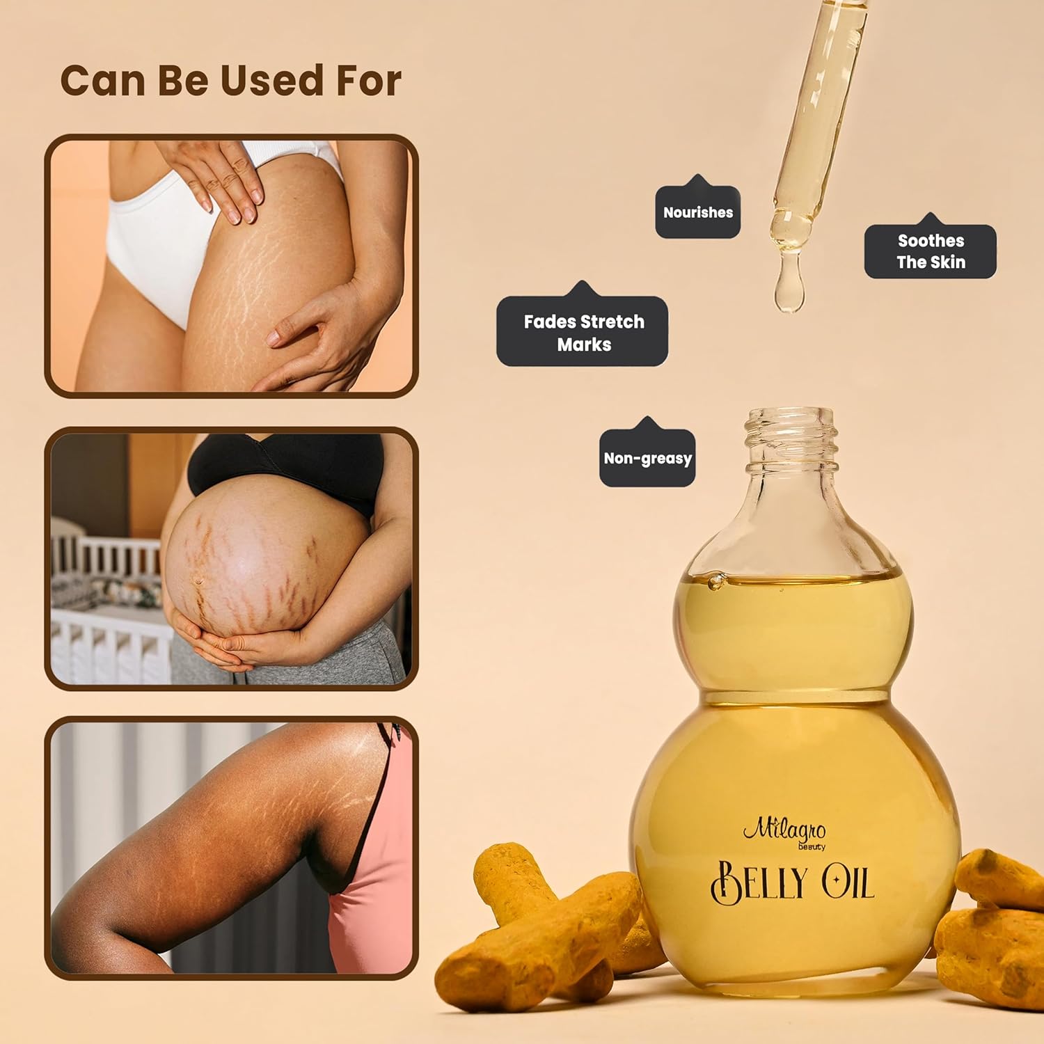 Milagro Beauty Ayurvedic Anti Stretch Marks Oil 100ml | Stretch Marks Removal Belly Oil | Safe for Pregnancy & Breastfeeding | Sweet Almond Oil + 20 Botanical Ingredients | Fades Old & New Scars