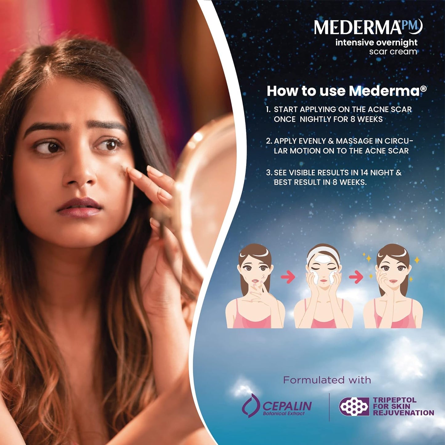 Mederma Pm Intensive Overnight Scar Cream - 30 gms