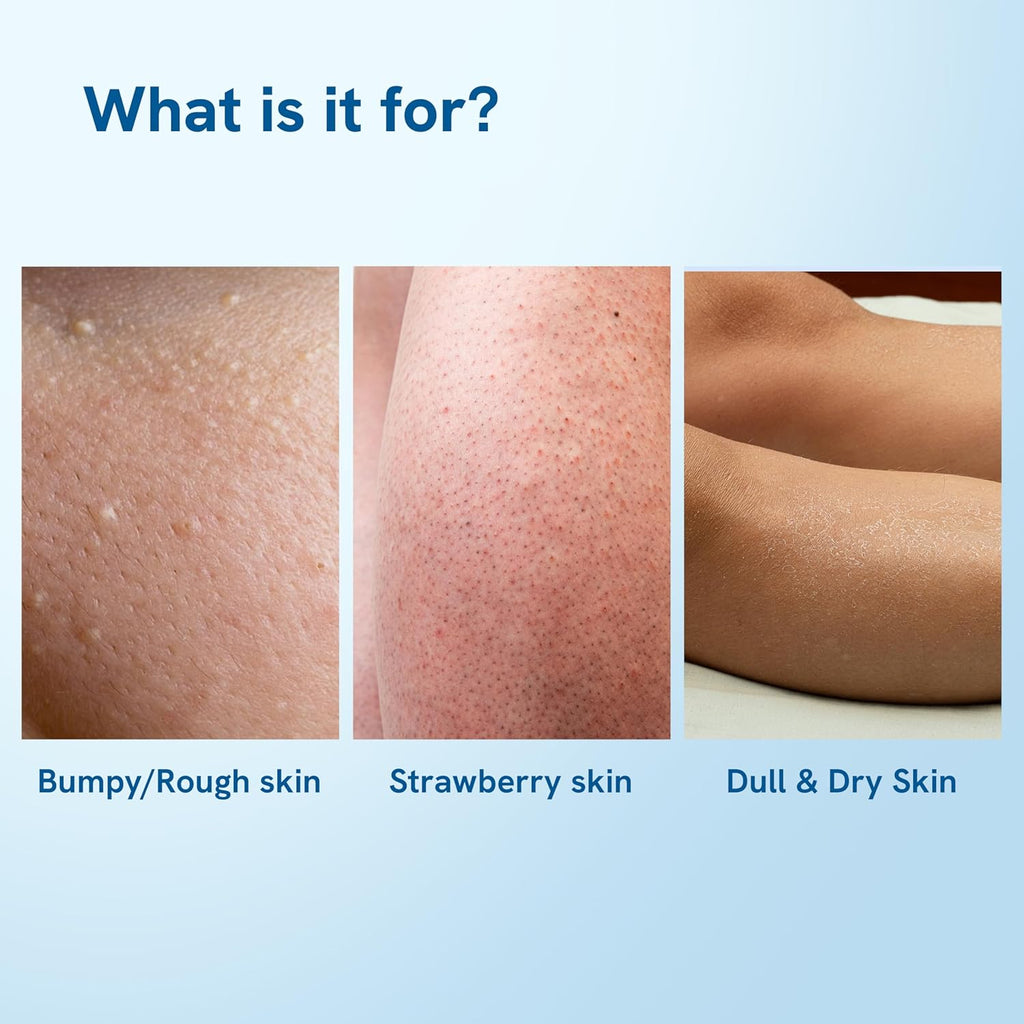 Be Bodywise 4% AHA BHA Shea Body Butter | 200g | With 48 hours of Intense Moisturization | For smooth and radiant skin