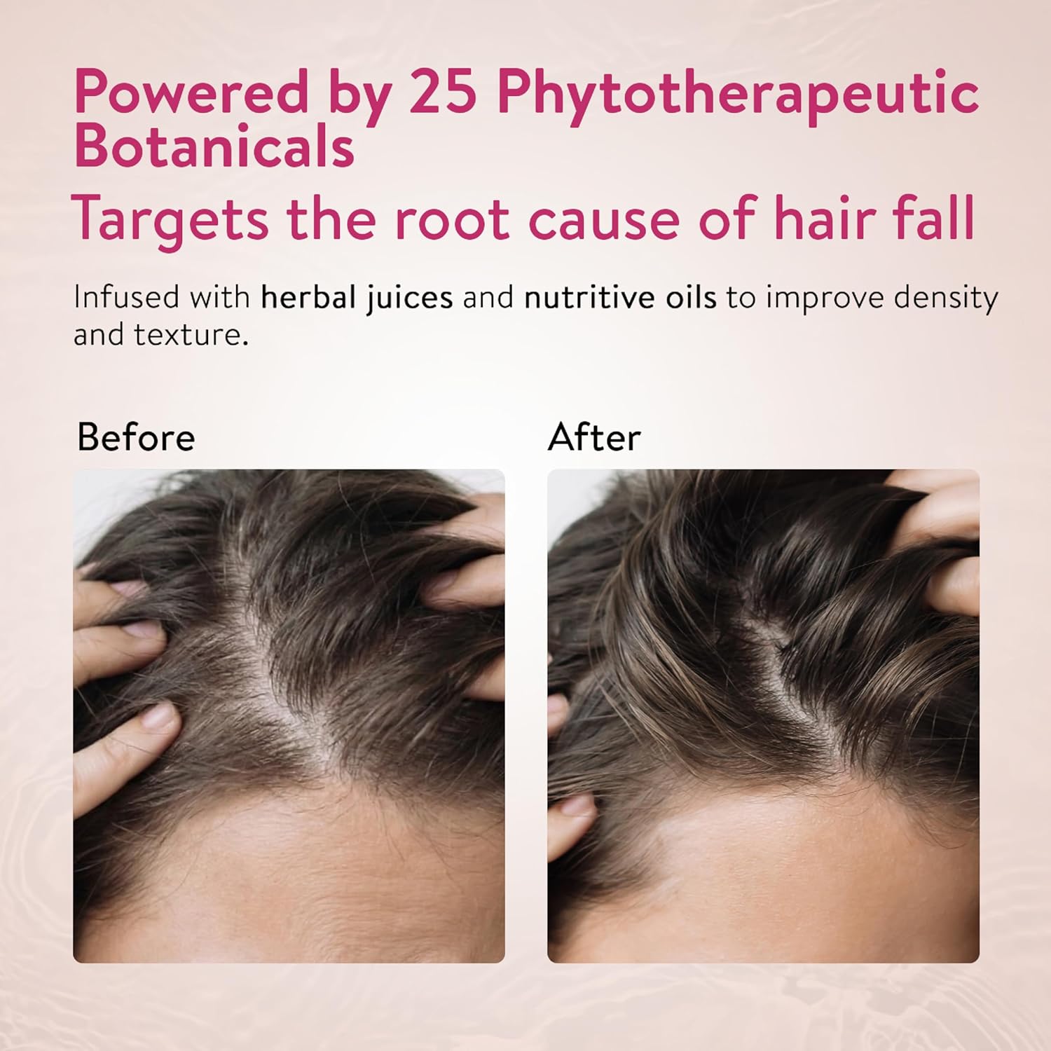 Ayouthveda Anti Hair Fall Shampoo with Onion & Coffee | Natural Formula with Aloe vera, Reetha, Shikakai & Neem | Reduces Hair Fall, Improves Hair Density & Scalp Health | 200 ml (Pack of 1)