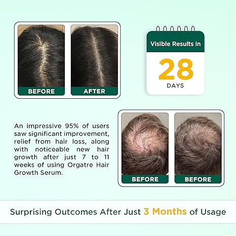Orgatre Hair Growth Serum for Scalp - 50 ml