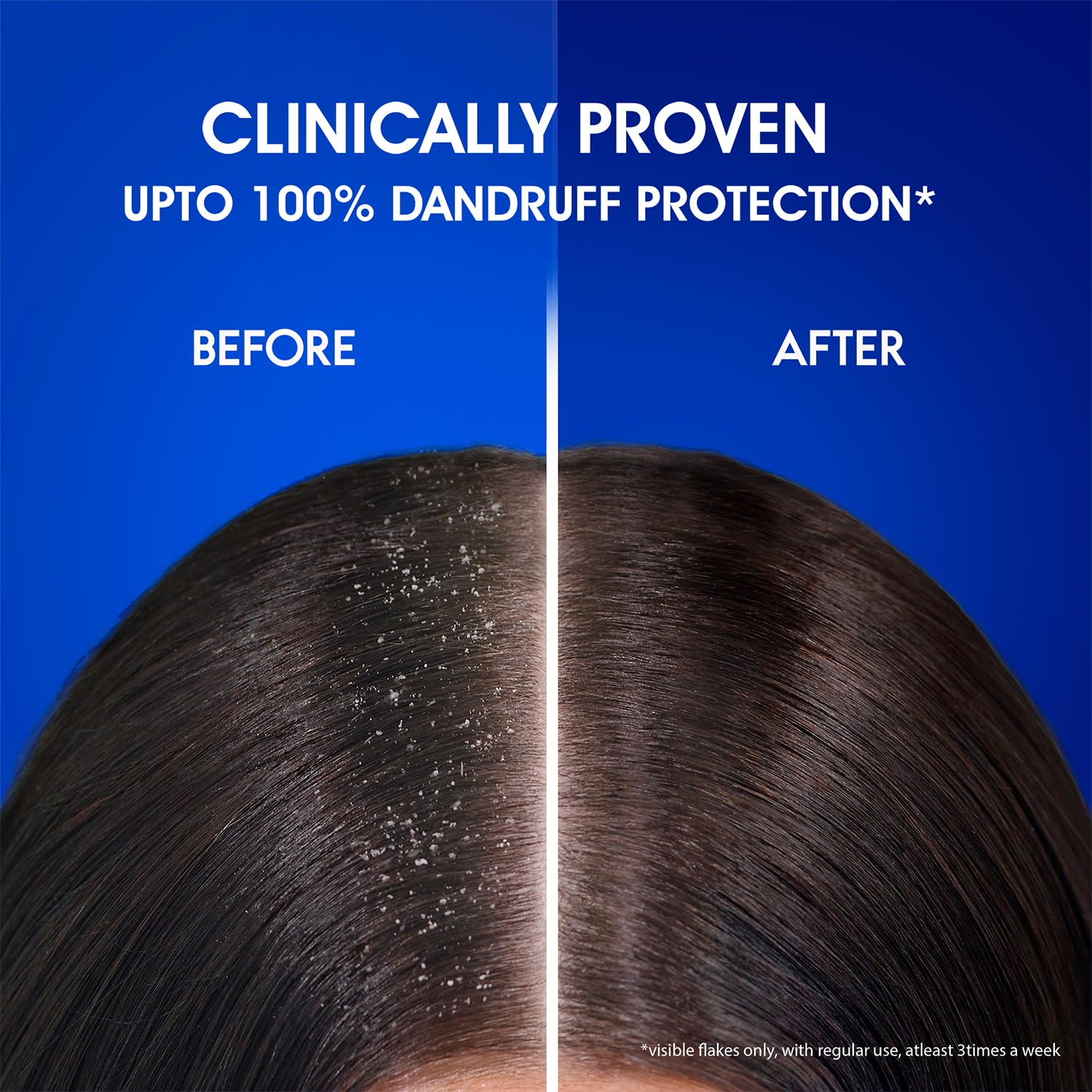 Head & Shoulders Smooth and Silky, Anti Dandruff Shampoo for Women & Men , 1 L