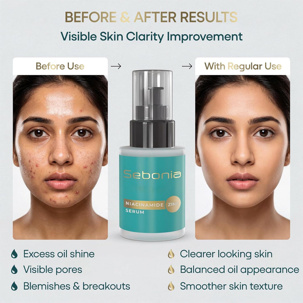 Sebonia Niacinamide Zinc Serum Pack of 1 (20ml)