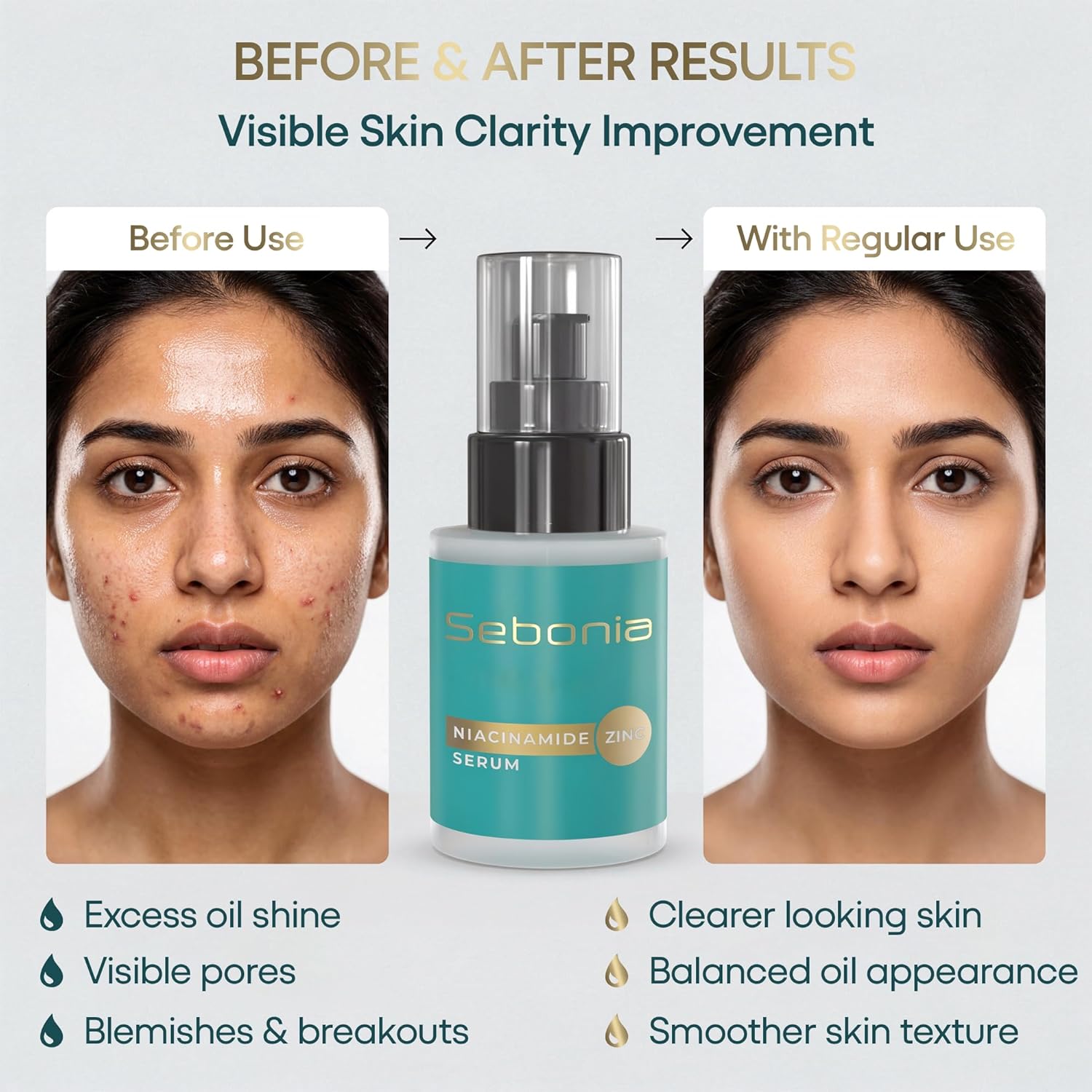 Sebonia Niacinamide Zinc Serum Pack of 1 (20ml)