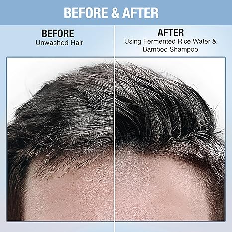 Nykaa Naturals Onion & Fenugreek Hair Growth Hair Serum - 50 ml