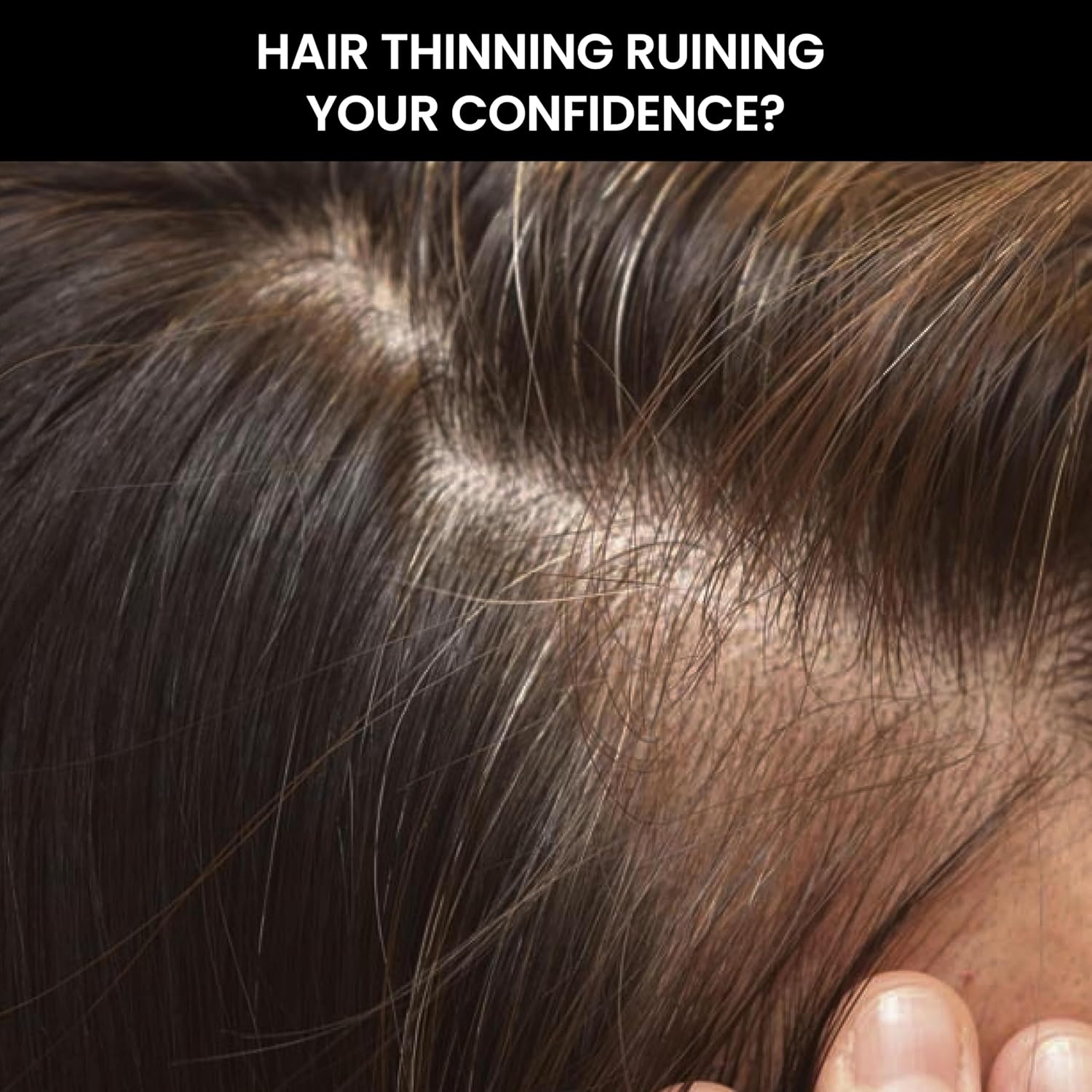 ThriveCo Hair Thickener Volumizing Serum | For Fine & Thinning Hair | Instantly Boosts Hair Volume & Density | With Pea Peptide & Rosemary | For Men & Women | Vegan & Cruelty-Free | 100 ml