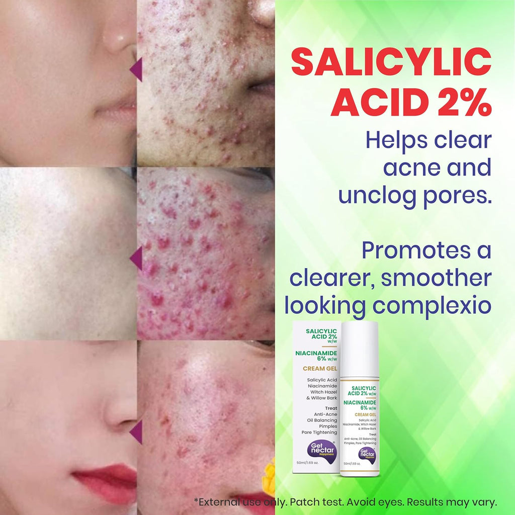 Get Nectar Happiness 2% Salicylic Acid 6% Niacinamide Acne Treatment Gel with Oil-Free for Active Acne, Pimples Oil Balancing, Pore Tightening & Brightens and Smoothens 50ml