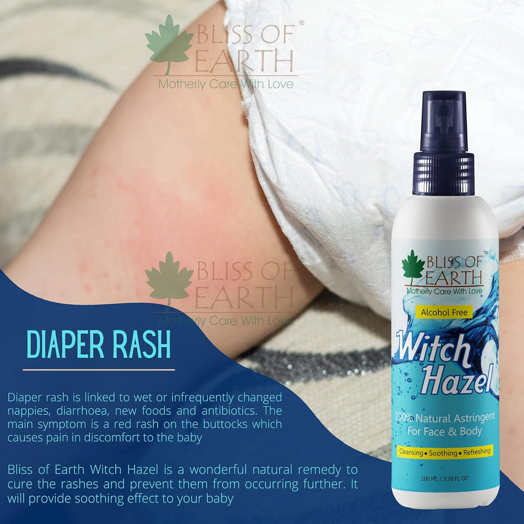 Bliss of Earth Witch Hazel Toner For Face, Acne & Oily Skin, Natural Pore Minimizer, Alcohol Free Facial Astringent, 100ml