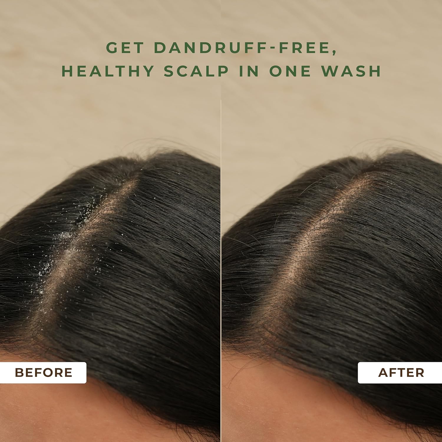 Naturali Anti Dandruff Shampoo with Sage & Salicylic Acid | No Sulphate No Paraben Shampoo | Calms Itchy Scalp | Exfoliates flaky scalp | Soothes Inflammation | 200 ml