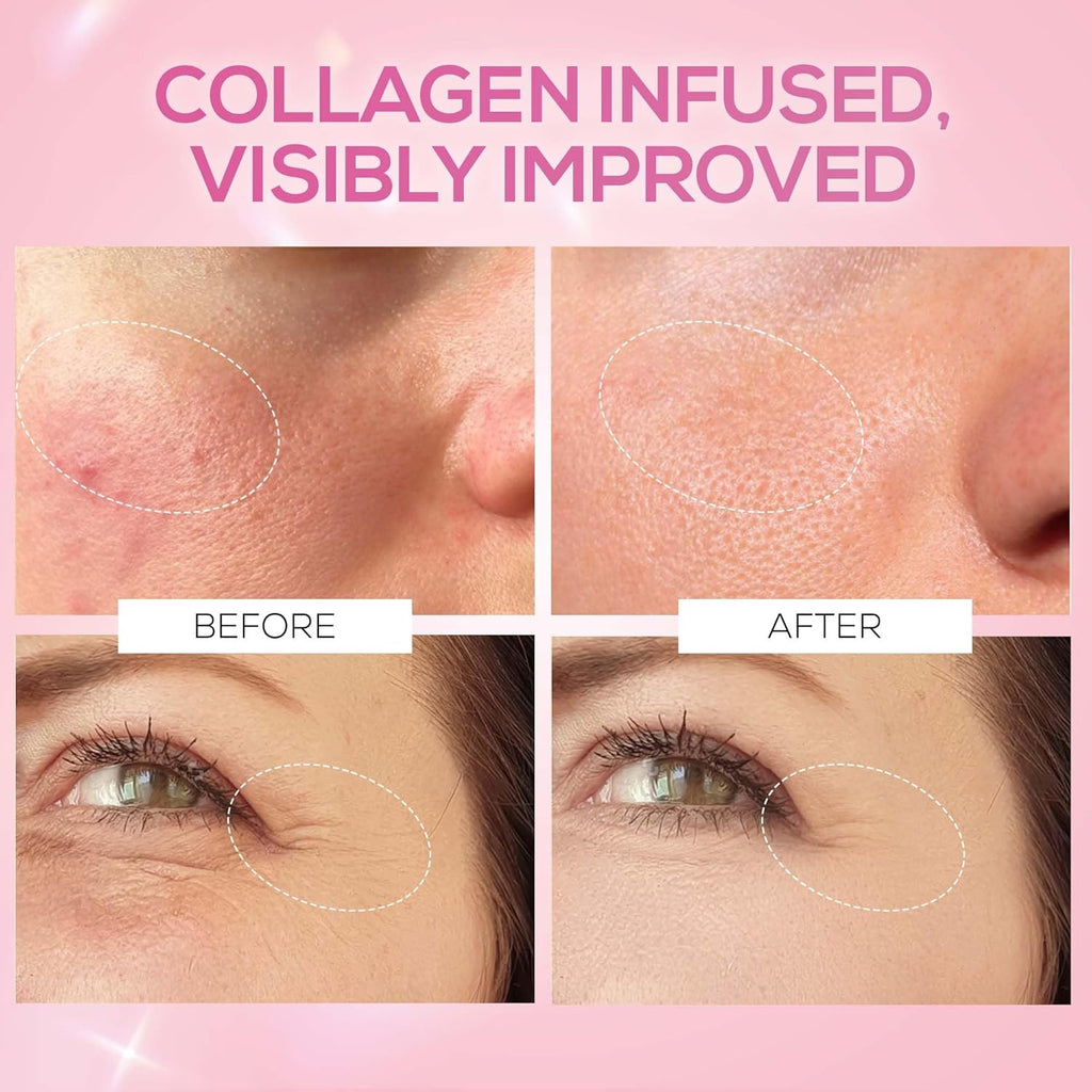 RENEE Pink Therapy Hydrolyzed Collagen Overnight Sleep Jelly Mask | Hydrates, Repairs, Smoothens & Plumps Skin | Peptides, Niacinamide & Hydrolyzed Collagen Enriched | 50 gm