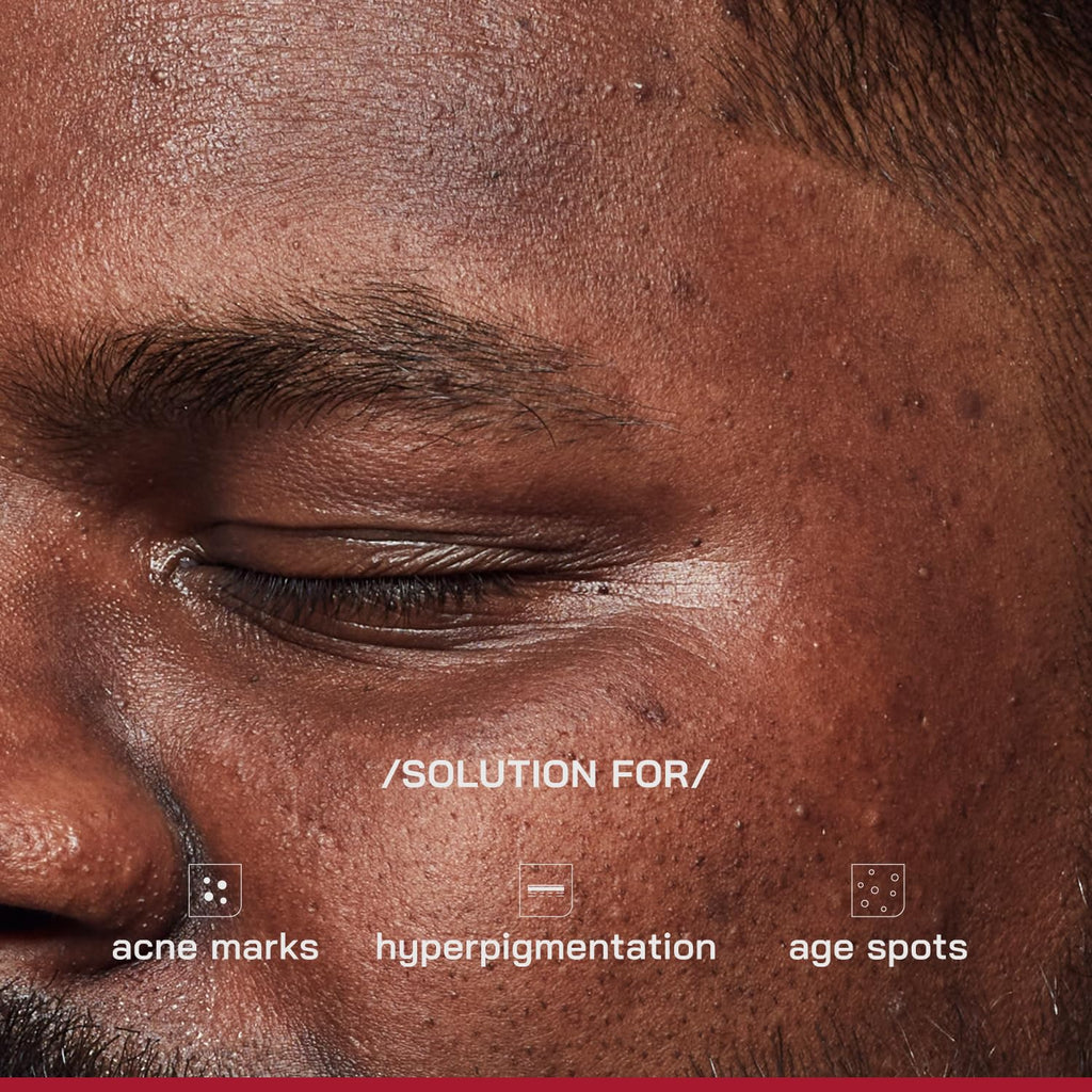Proven Honest Derma /PHD/ 2% Alpha Arbutin Depigmentation Serum | Alpha Arbutin for Pigmentation & Dark Spot | Pigmentation serum for Women & Men | Tyrobrightâ„¢, Niacinamide | Tan removal | Fragrance-Free | 30ml