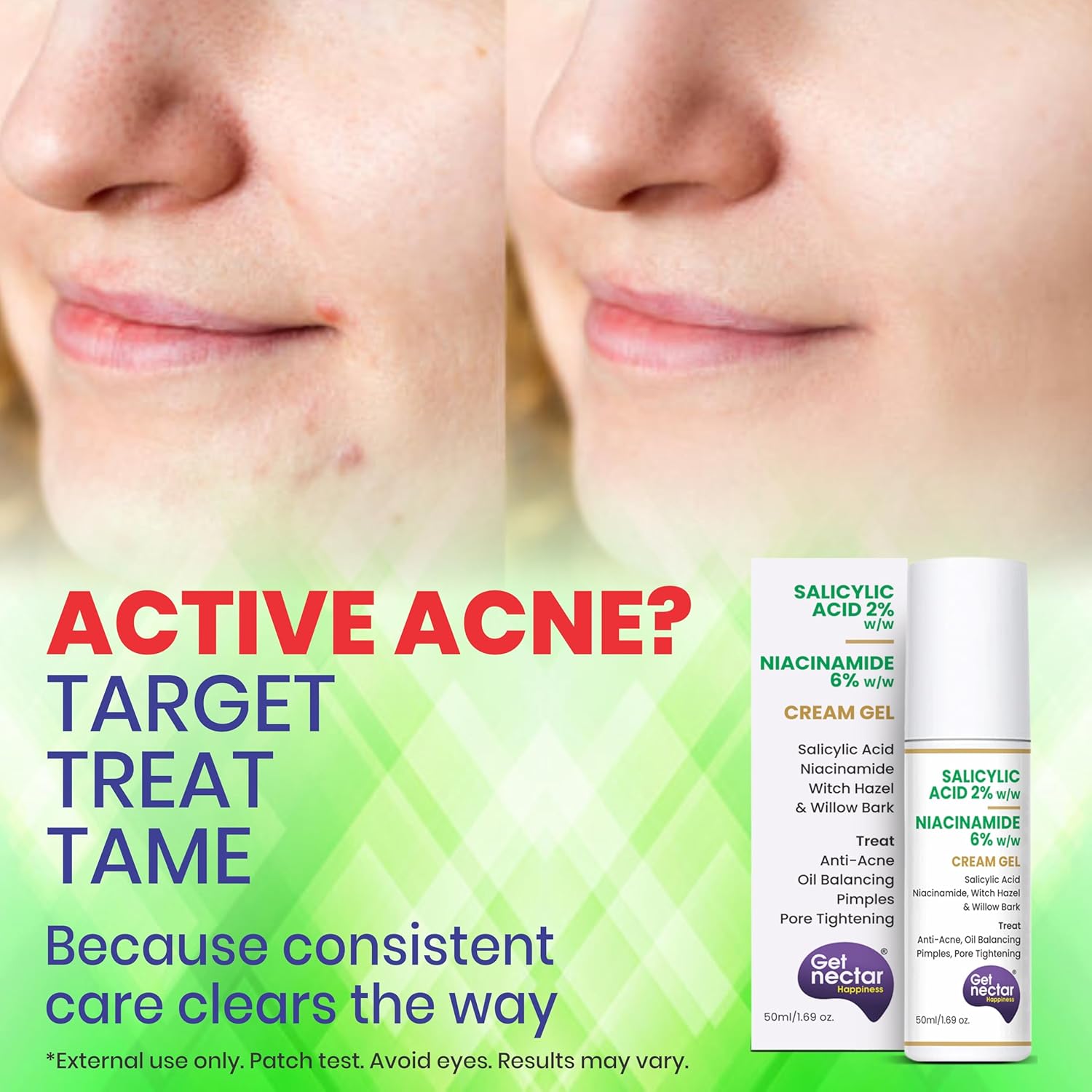 Get Nectar Happiness 2% Salicylic Acid 6% Niacinamide Acne Treatment Gel with Oil-Free for Active Acne, Pimples Oil Balancing, Pore Tightening & Brightens and Smoothens 50ml