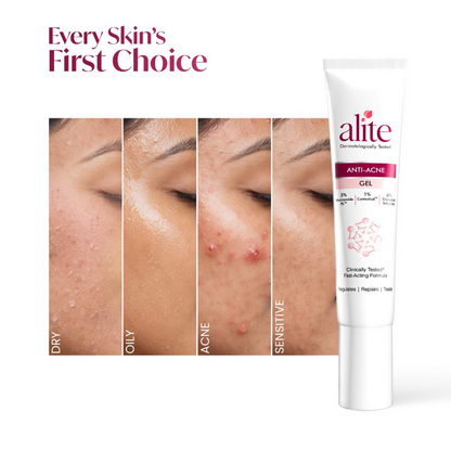 Alite Anti Acne Gel