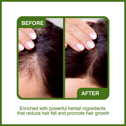 She Essentials Amla Bhringraj Hair Oil For Anti Dandruff & Hair Growth