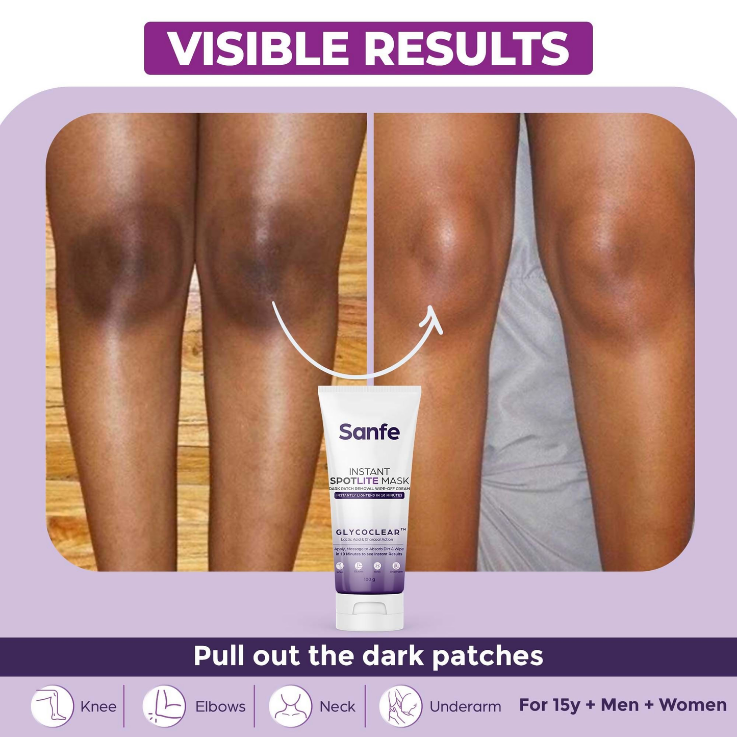 Sanfe Instant Spotlite Mask For Dark Underarm